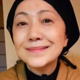 石川さゆりのほくろ除去は本当？画像比較で見える違い