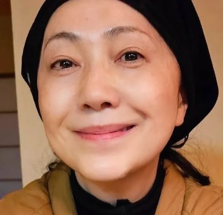 石川さゆりのほくろ除去は本当？画像比較で見える違い